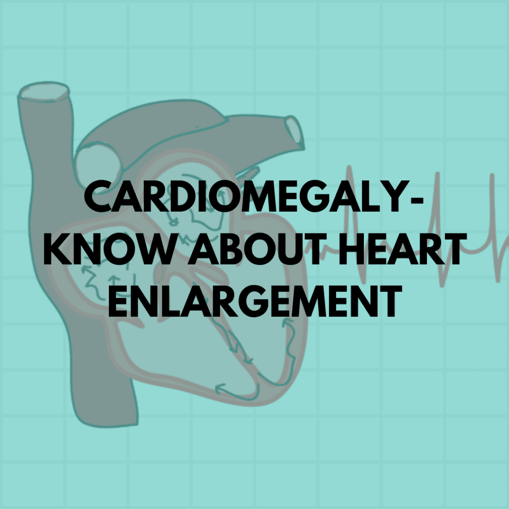 Cardiomegaly Know About Heart Enlargement > Niruja HealthTech