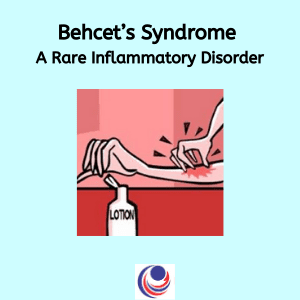 Behcet’s Syndrome 