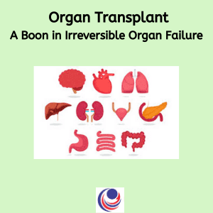 Organ Transplant