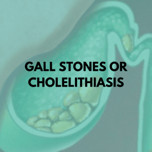Gall stones