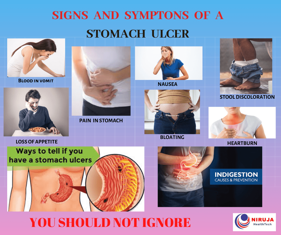 Stomach ulcer signs and symptoms