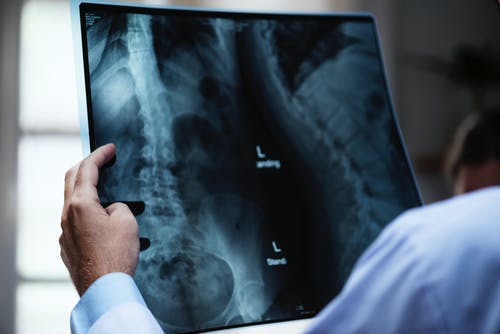 Interventional neurology