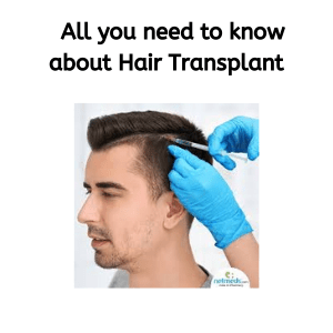 _ All you need to know about Hair Transplant