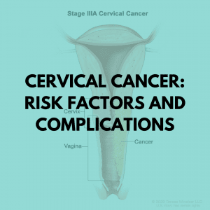Cervical Cancer