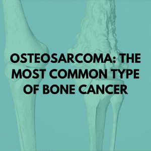 Osteosarcoma