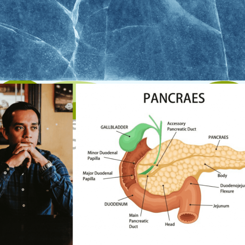 pancreas transplant