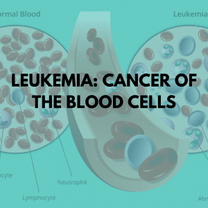 Leukemia Cancer