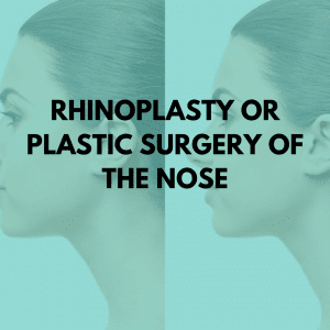 Rhinoplasty