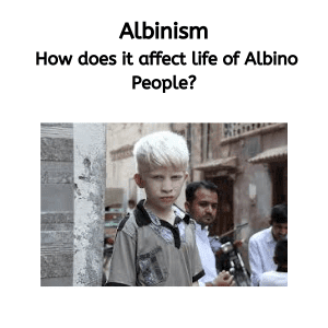 Albinism