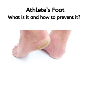 Athlete’s Foot