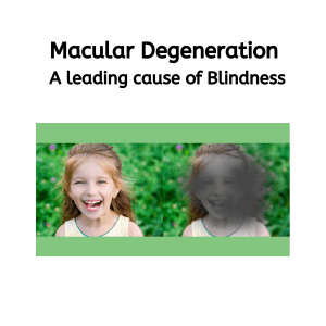 Macular Degeneration_