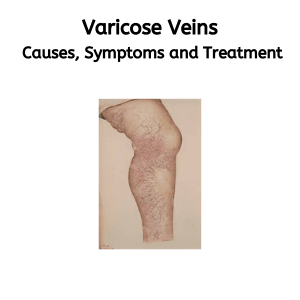 Varicose Veins