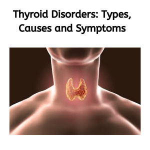 Thyroid Disorders