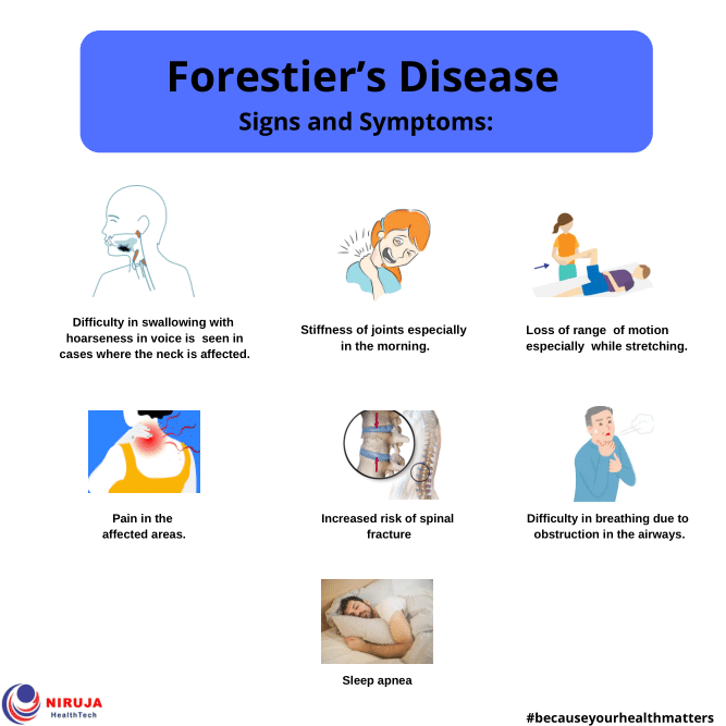 Maladie De Forestier Essais Cliniques PBGWE — free download
