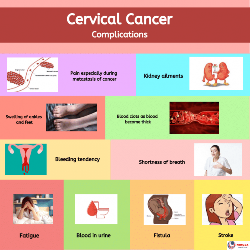 Cervical cancer complications