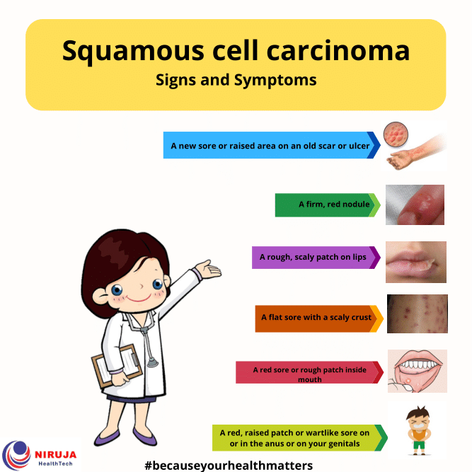 Squamous Cell Carcinoma Skin Cancer Symptoms