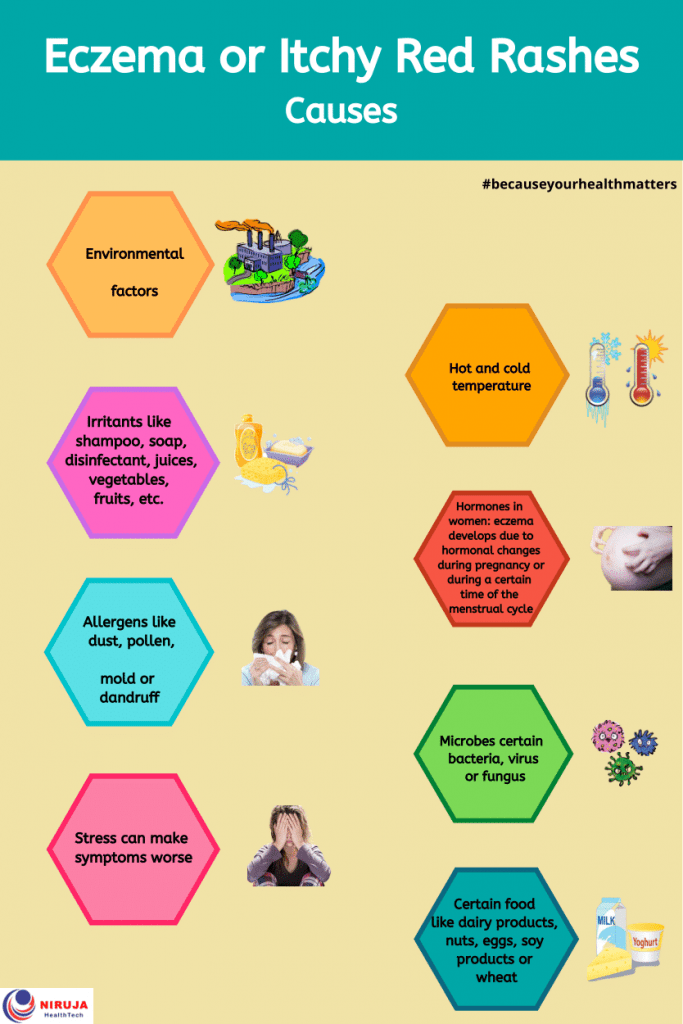 Eczema or itchy red rashes: Causes