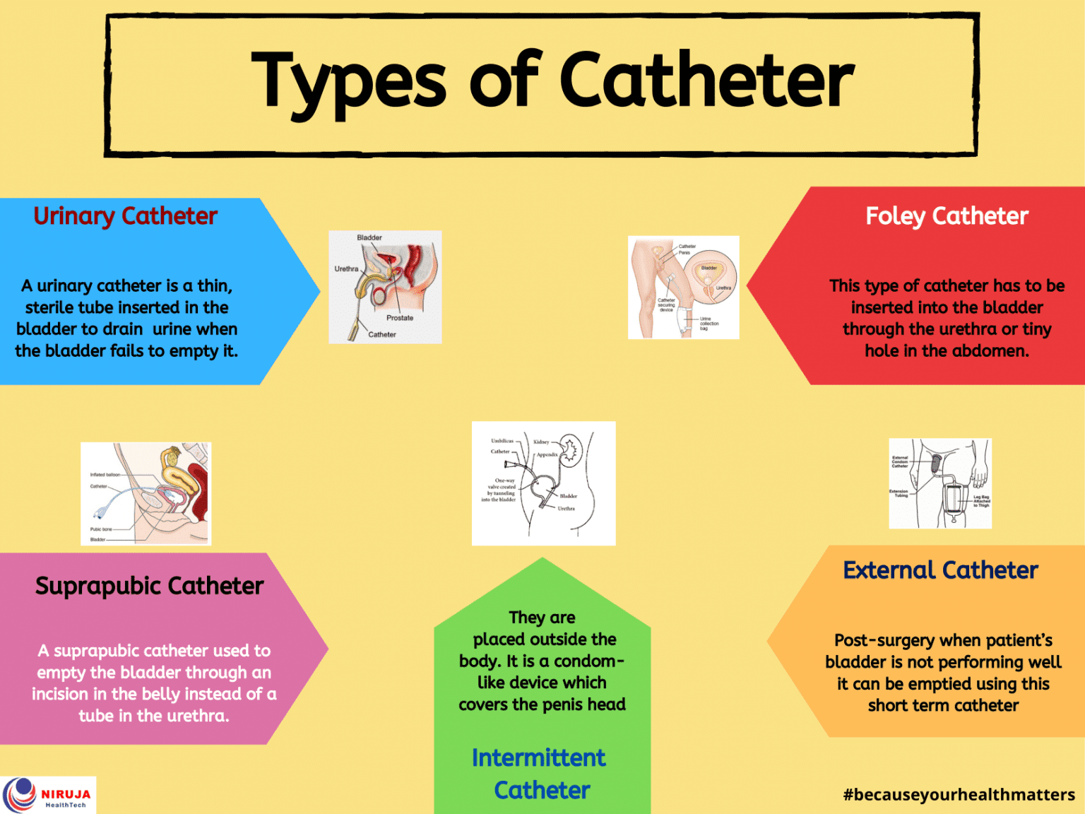 Male Catheters Types