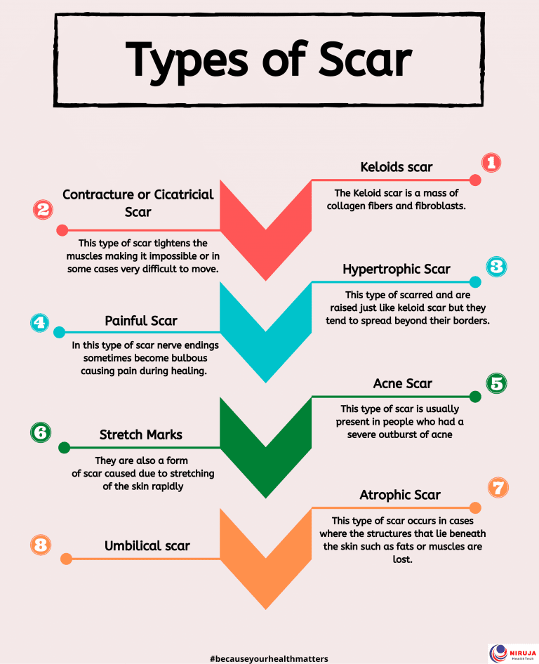 types of scar